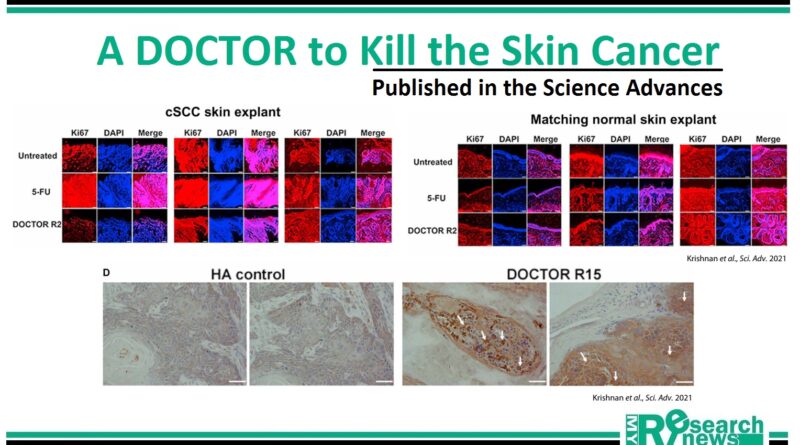 A DOCTOR to Kill the Skin Cancer